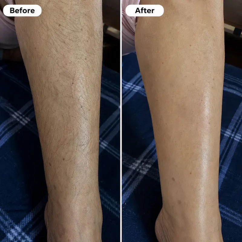 Beedo™ Hair Removal Cream