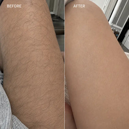 Beedo™ Hair Removal Cream